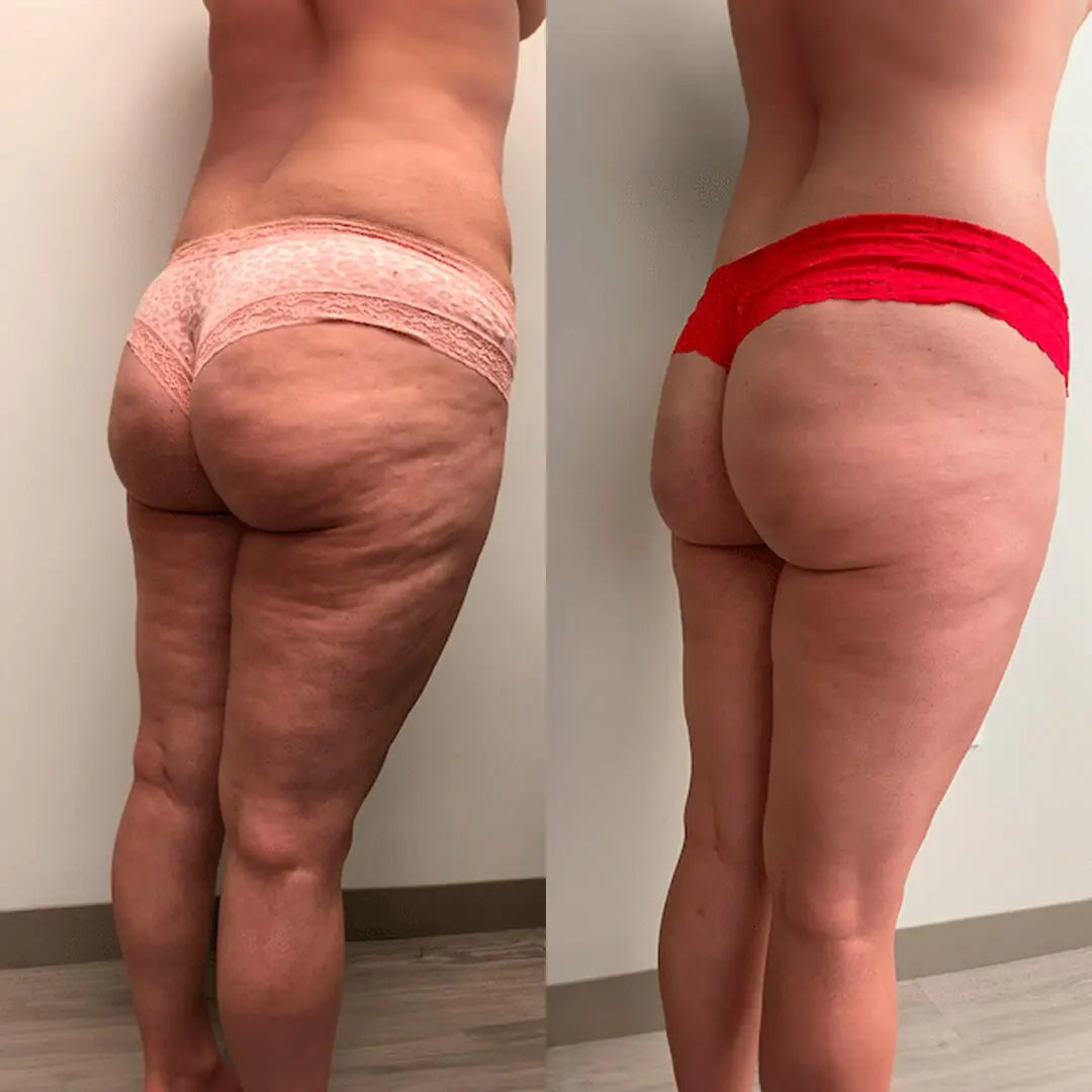 The Original Sculpiflex™ 3-in-1